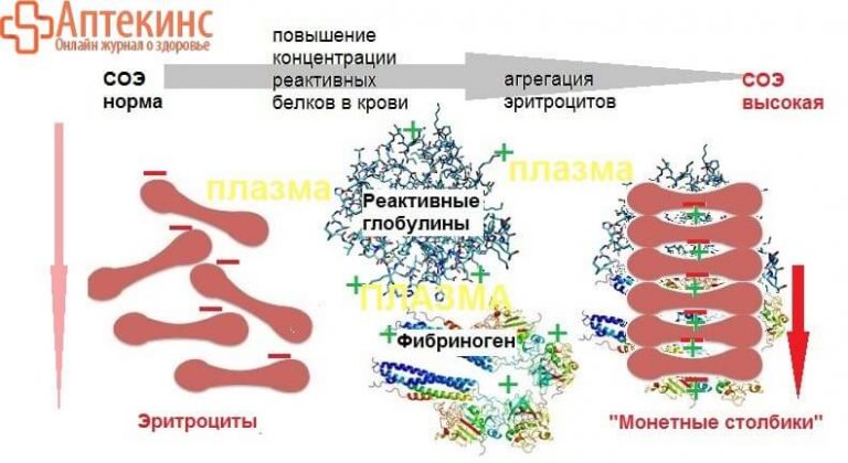 СОЭ – норма в крови у женщин, причины повышения