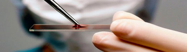 Расшифровка биохимического анализа крови wbc thumbnail