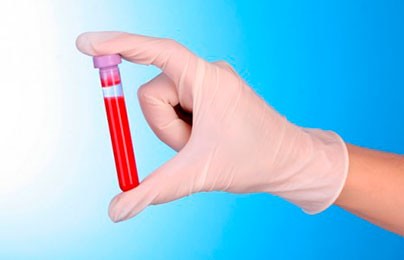 биохимический анализ крови расшифровка 