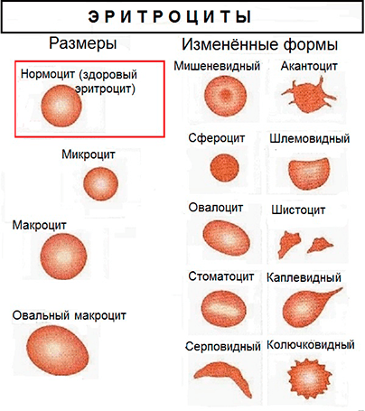 MCV в анализе крови таблица