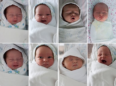 Желтуха новорожденных – причины, последствия