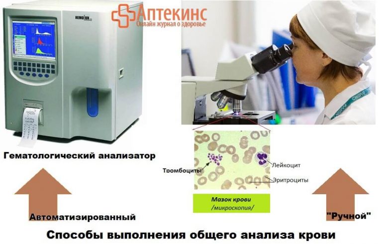 PLT (Тромбоциты) в анализе крови: что это, расшифровка, норма для ...